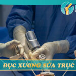 đục xương sửa trục