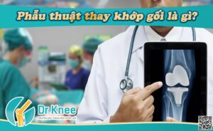 phẫu thuât thay khớp gối