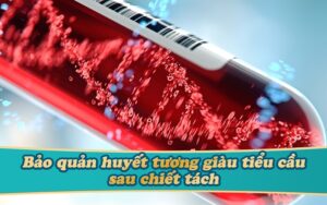 quy trình chiếc tách huyết tương giàu tiểu cầu