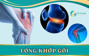 lỏng khớp gối