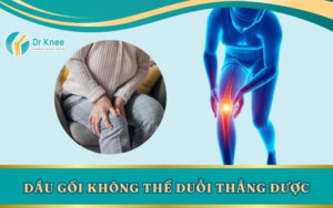 đầu gối không thể duỗi thẳng được