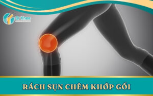 Rách Sụn Chêm Khớp Gối