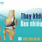 chi phí thay khớp gối bao nhiêu tiền
