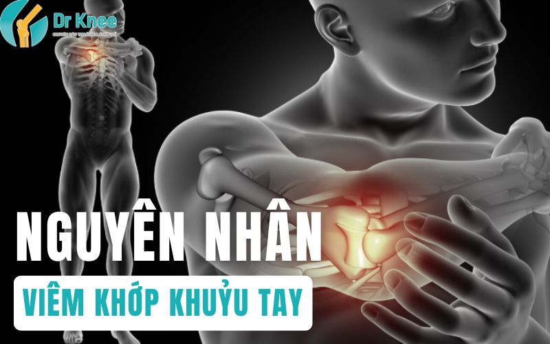 nguyên nhân viêm khớp khuỷu tay