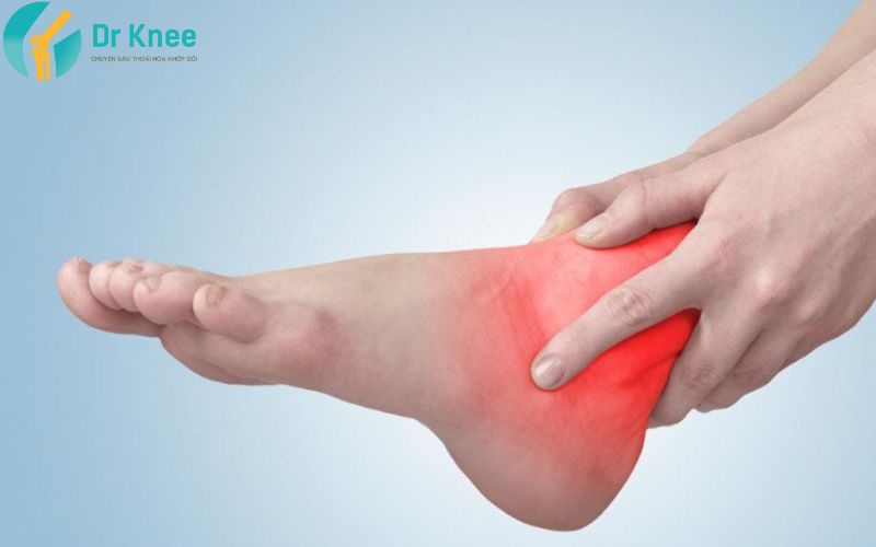 điều trị viêm khớp cổ chân