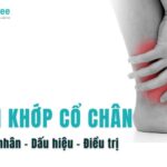viêm khớp cổ chân