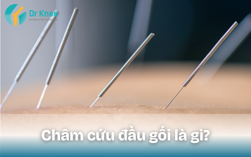 Châm cứu đầu gối là gì