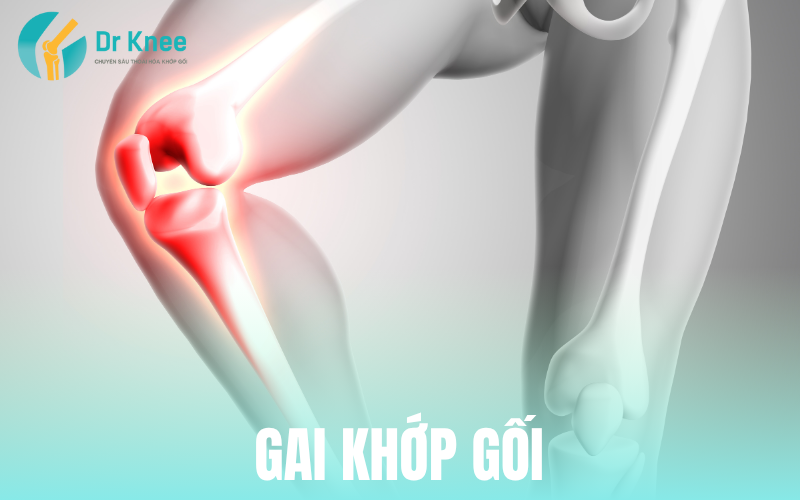 Gai khớp gối